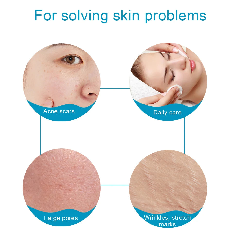 Derma Roller Skin Care Micro Needle Dermaroller Professional Derma Roller For Hair Growth Beard Growth Facial Beauty Roller